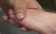 수족구병